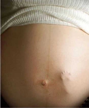 Artistic εικόνα με το πόδι του εμβρύου